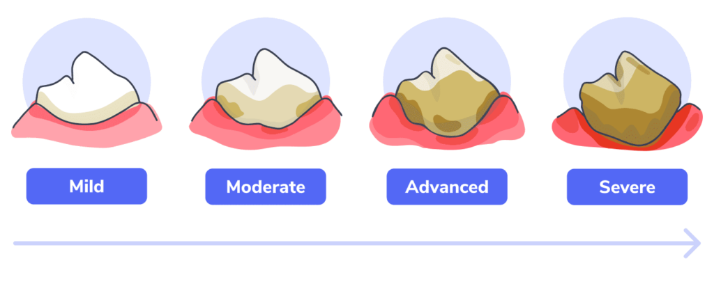 illustration of the four stages of canine dental disease