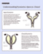 Infographic on dog pyometra showing open vs closed cervix uterus diagrams with labels showing the pus location for open vs closed. "In cases of open pyometra, the cervix does not fully close. This creates a channel that allows the accumulation of infected fluid and pus within the uterus to drain out through the vagina. It is often easier to detect this condition because the parent may observe vaginal discharge or staining on the dog’s bedding." "When the cervix is tightly closed, the infected material is trapped inside the uterus with no means of escape. As the fluid accumulates, the uterus continues to stretch and distend, rapidly increasing the internal pressure. Because no external discharge is visible, this form of the disease can go unnoticed until the dog becomes severely ill, increasing the risk of a life-threatening uterine rupture."